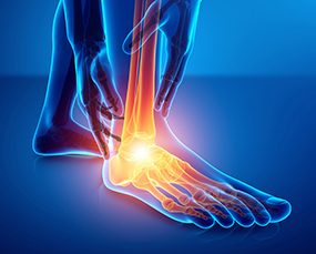 Foot & Ankle Sprains