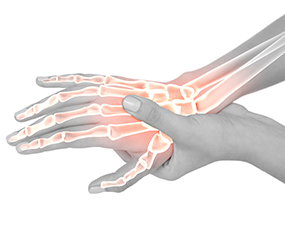 Wrist Pain & Carpal Tunnel Syndrome